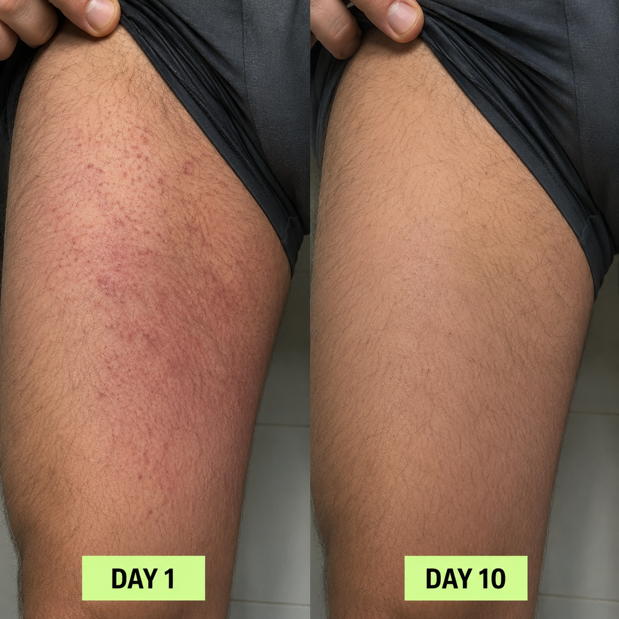 MONA ANTIFUNGAL SOAP