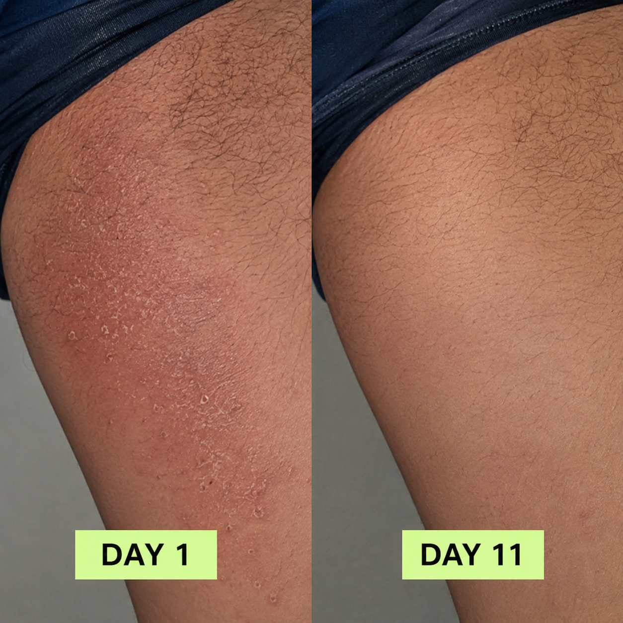 MONA ANTIFUNGAL SOAP